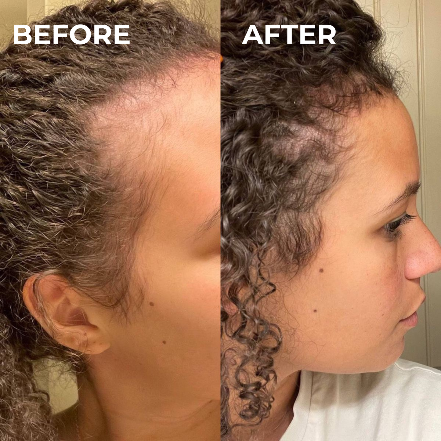 GROWTH & BREAKAGE REPAIR OIL 50ML