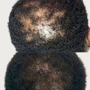 NOURISHING, ROOT REVIVAL GROWTH OIL