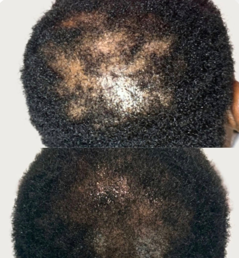 NOURISHING, ROOT REVIVAL GROWTH OIL