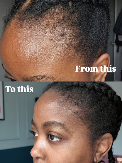 NOURISHING HAIR AND SCALP OIL