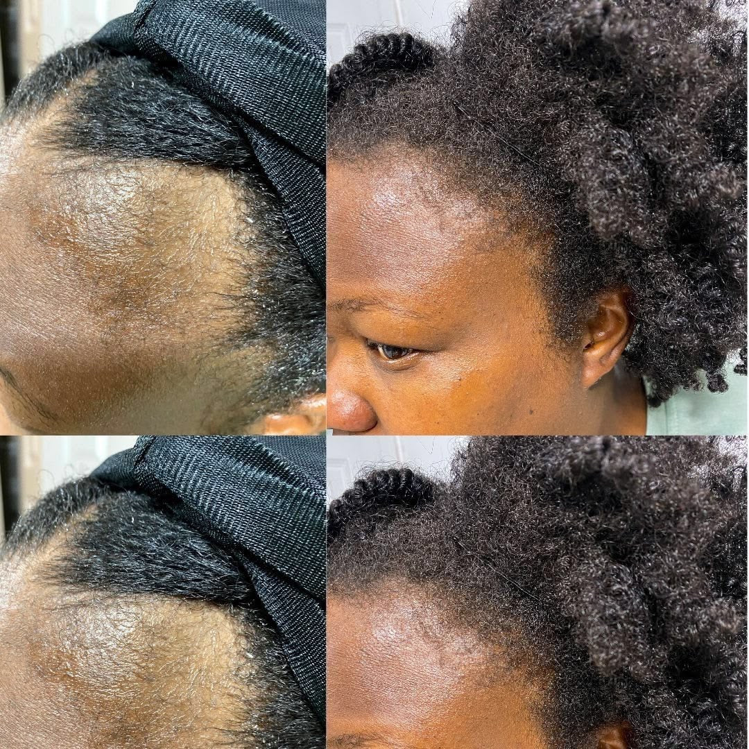 NOURISHING HAIR AND SCALP OIL