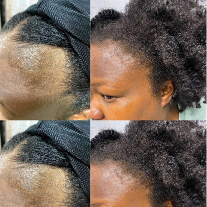 NOURISHING HAIR AND SCALP OIL