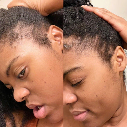 NOURISHING HAIR AND SCALP OIL