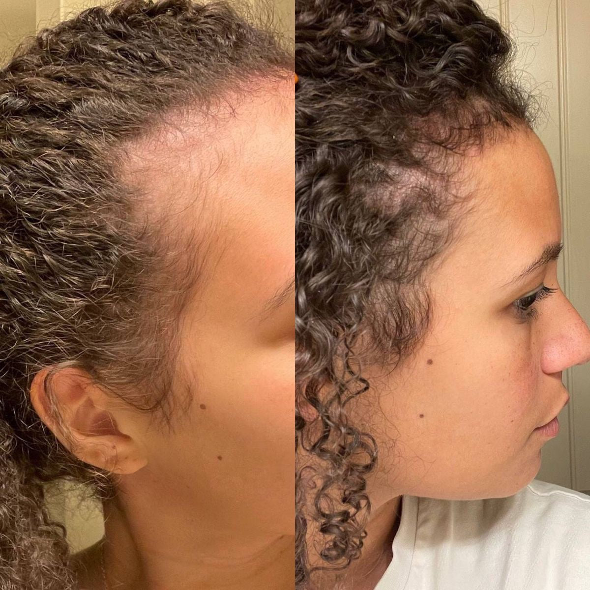NOURISHING HAIR AND SCALP OIL